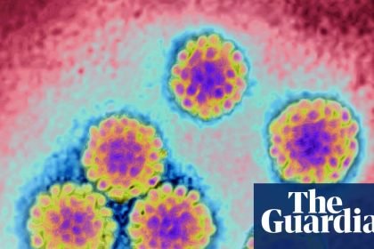 NHS England to offer women ‘gamechanging’ free home testing kits for cervical cancer