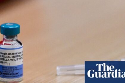 Pennsylvania measles outbreak spreads, with 55 new cases reported since Wednesday