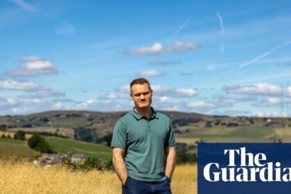 Experience: a brain surgeon dropped part of my skull on the floor