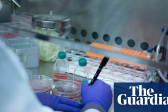 Only 3% of US sickle cell patients receive red blood cell exchange for disease, researchers find