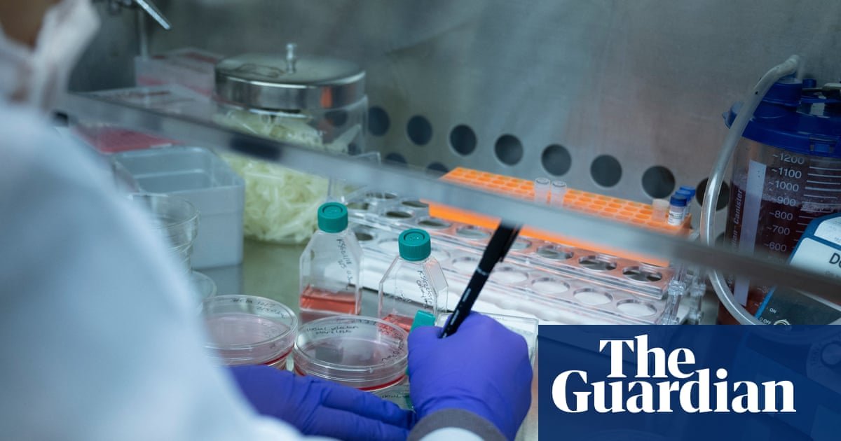 Only 3% of US sickle cell patients receive red blood cell exchange for disease, researchers find
