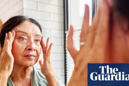 Ferritin face: the new health scare taking social media by storm