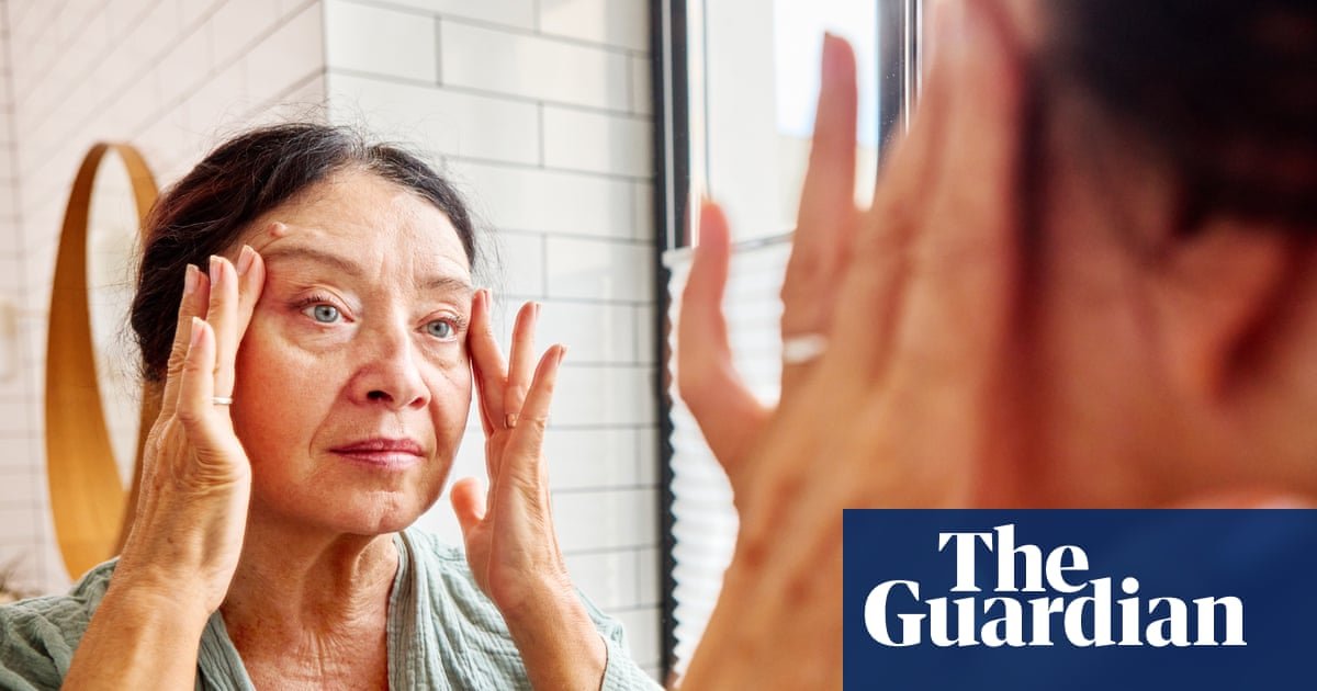 Ferritin face: the new health scare taking social media by storm