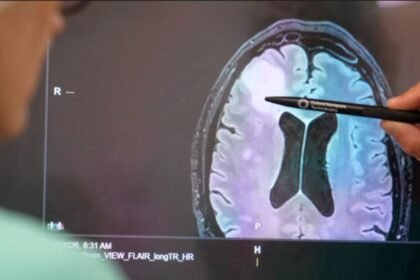 How a rapid new test is helping brain tumour patients