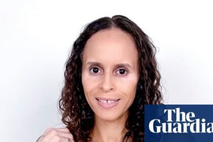 A moment that changed me: I felt hugely self conscious about my skin - until I had a revelation