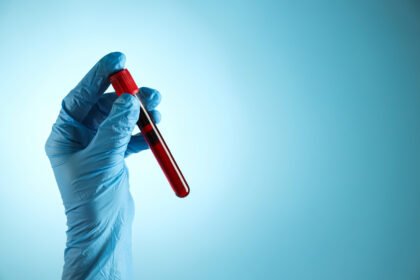 Who Should Get a Blood Test for Alzheimer's Disease?