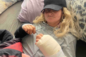 San Francisco woman who narrowly survived dog attack relives the horror: ‘I kept hearing the crunching sound’