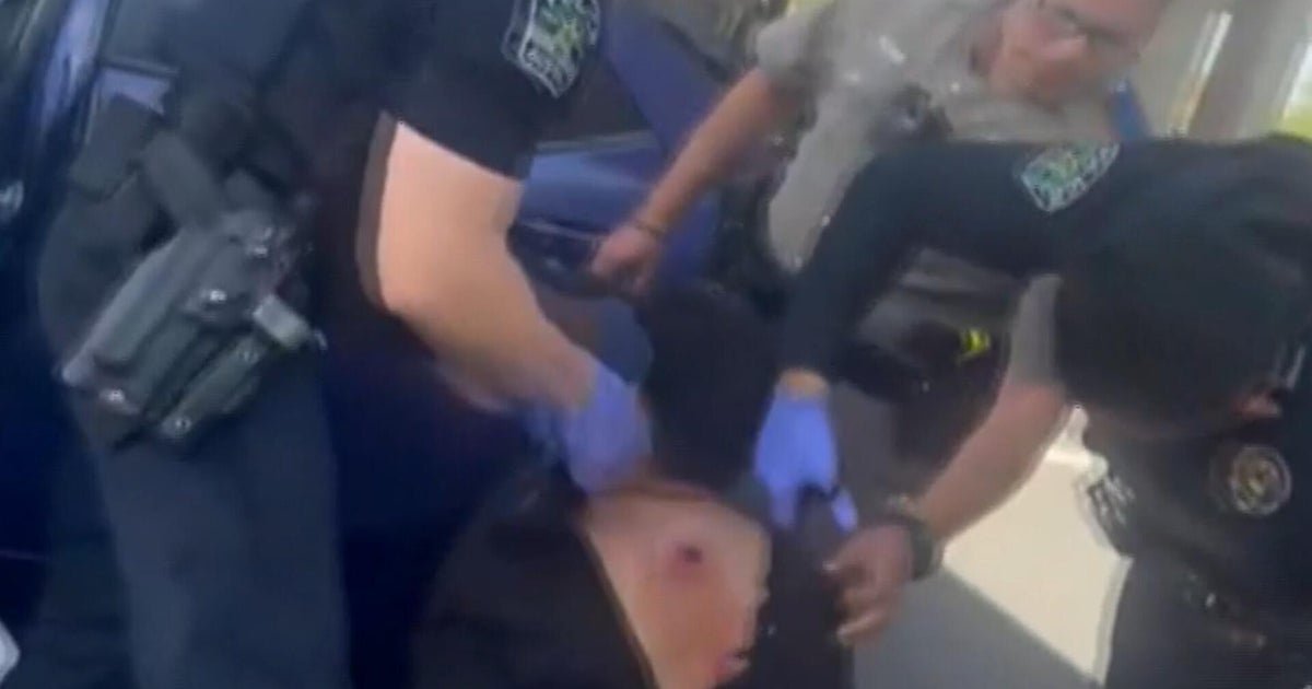 Man shot by ICE in custody with bullet lodged near his spine, lawyer says