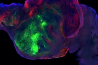 Neuroscientist explains how his team grew human brain tissue in mice and breaks down what they found