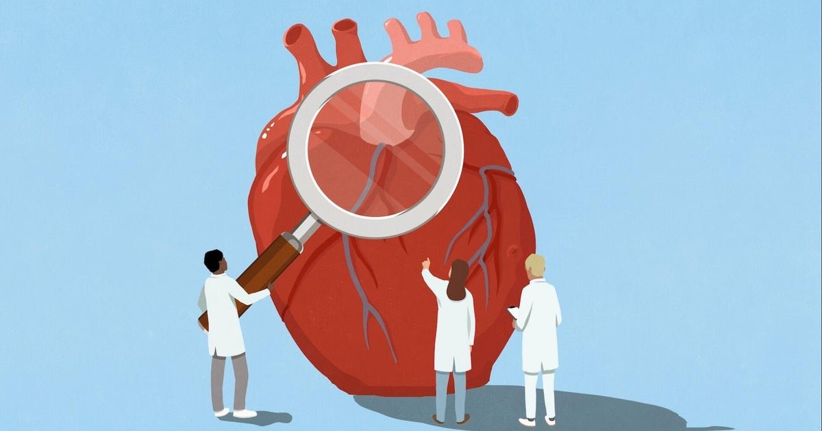 What to know about atrial fibrillation