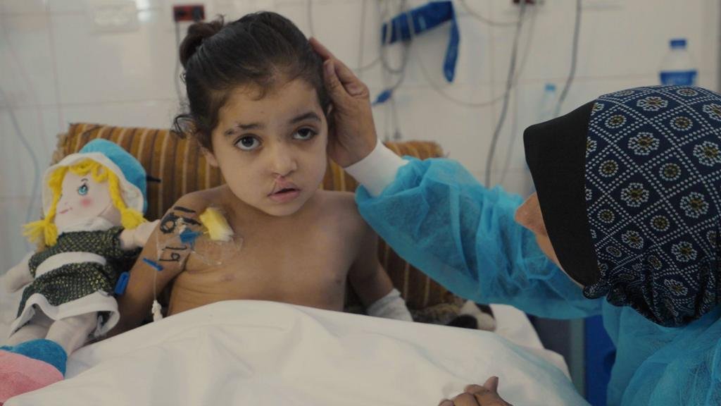 Girl has multiple surgeries to control infections after strike in Gaza