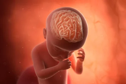 Rare pregnancy infections may triple the risk of autism