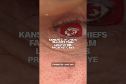 Kansas City Chiefs fan gets team logo on his prosthetic eye