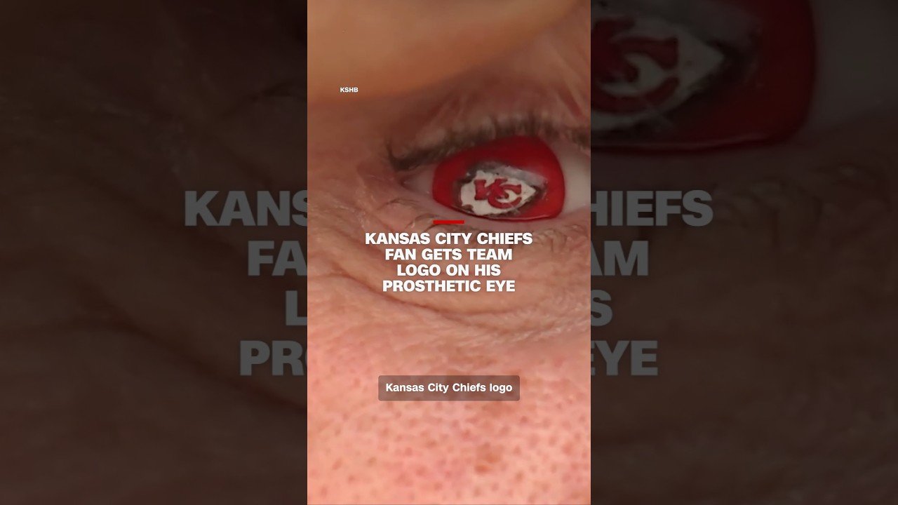 Kansas City Chiefs fan gets team logo on his prosthetic eye