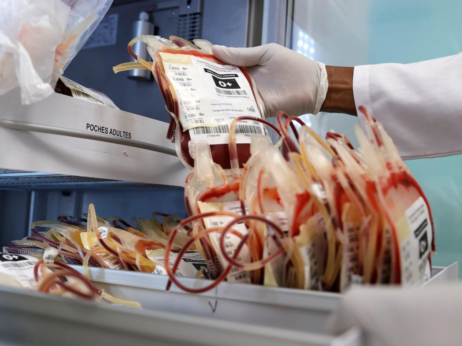 Scientists warn of weakening health systems and urge stronger outbreak detection