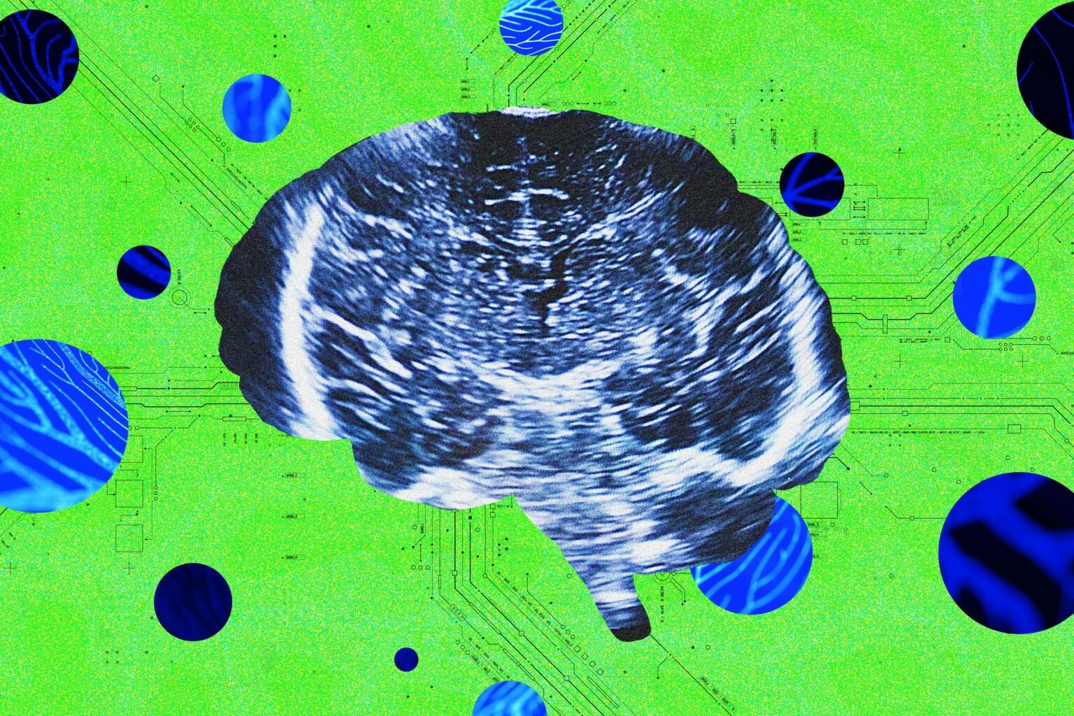 A New Neurotech Startup Launches to Rival Sam Altman’s Merge Labs