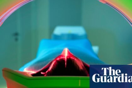Cancer rates rising more quickly among younger people, international study finds