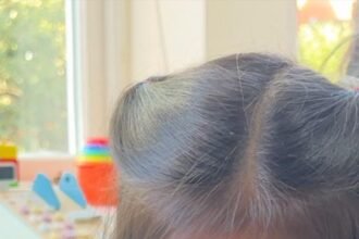 Parents' plea for kidney transplant for daughter