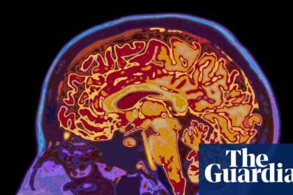 The incredible science of memory manipulation – podcast