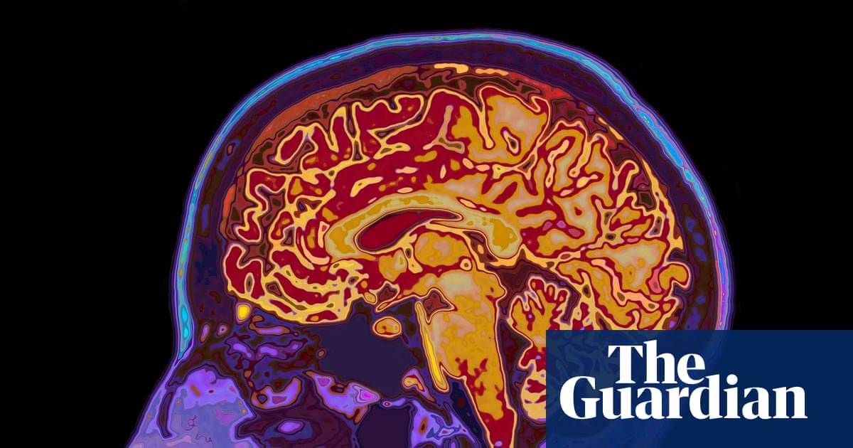 The incredible science of memory manipulation