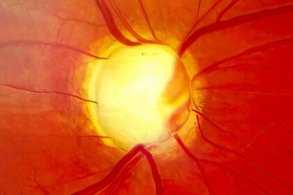 Eye Cells May Have Been Rejuvenated for the First Time in People