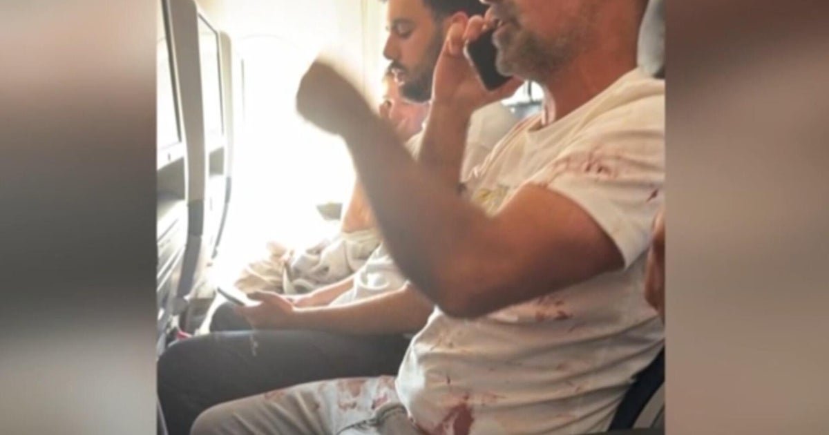 Alleged pilot stabbing aboard Israel-bound flight investigated as possible terrorism