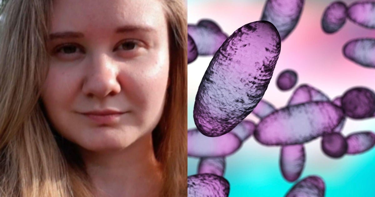 Russia downplays plague fears after lab researcher's death
