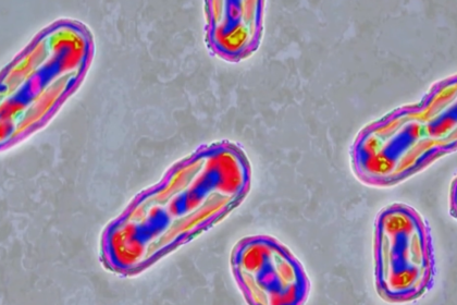 Medical experts on plague risks after reported death of lab worker in Russia
