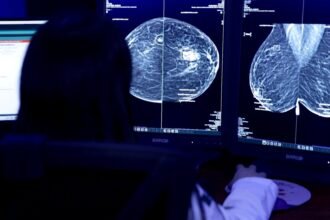 How AI is helping Mexico detect breast cancer earlier