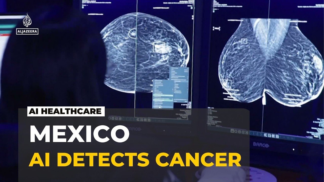 Bridging Mexico's public health gap: AI strengthening early breast cancer detection