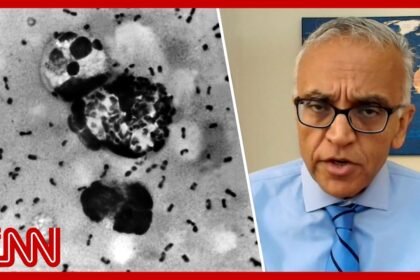 Ex-Covid czar: Potential Russia plague case raises ‘red flags’