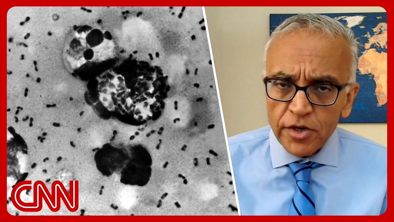 Ex-Covid czar: Potential Russia plague case raises ‘red flags’